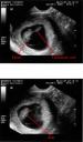 ultrasound11.jpg