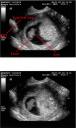 ultrasound21.jpg