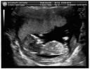 Ultrasound1
