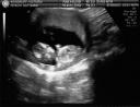Ultrasound6