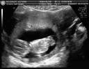 Ultrasound7